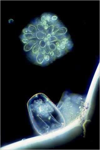 Synura (above) and rotifer egg.