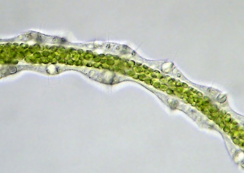 Tentacle of Hydra viridis showing nematocysts
