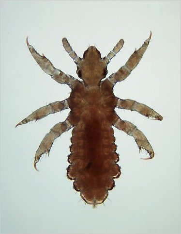 Young human head louse.