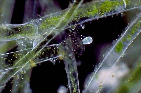 Coleps feeding on algal cell contents.