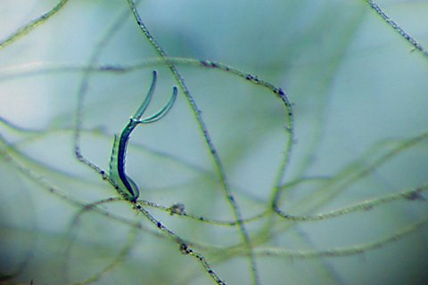 Ciliate amongst algae. x60