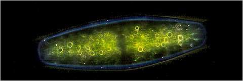 Netrium: Showing chloroplast.