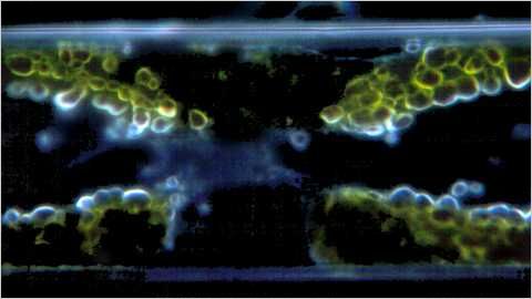 Diatom chloroplast.