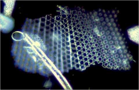 Fragments of diatom frustule.