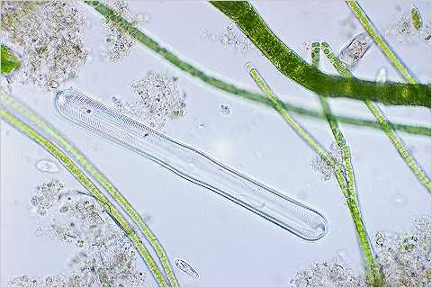 Pinnularia and algae.