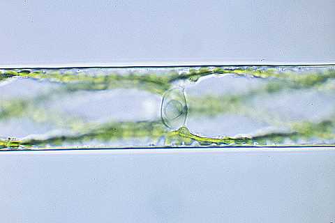 Spirogyra: cell showing nucleus.